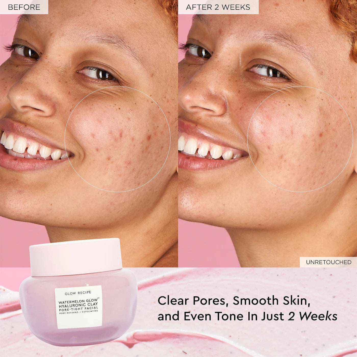 Glow Recipe - Watermelon Glow Hyaluronic Clay Pore-Tight Facial Mask