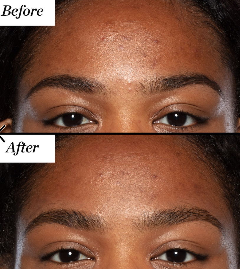 Sunday Riley - Good Genes All-In-One AHA Lactic Acid Treatment